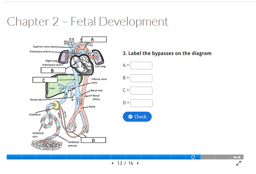 Interactive slides in H5P that have been embedded in a Canvas page, displaying a diagram with empty boxes, prompting students to label the bypasses in the human body.